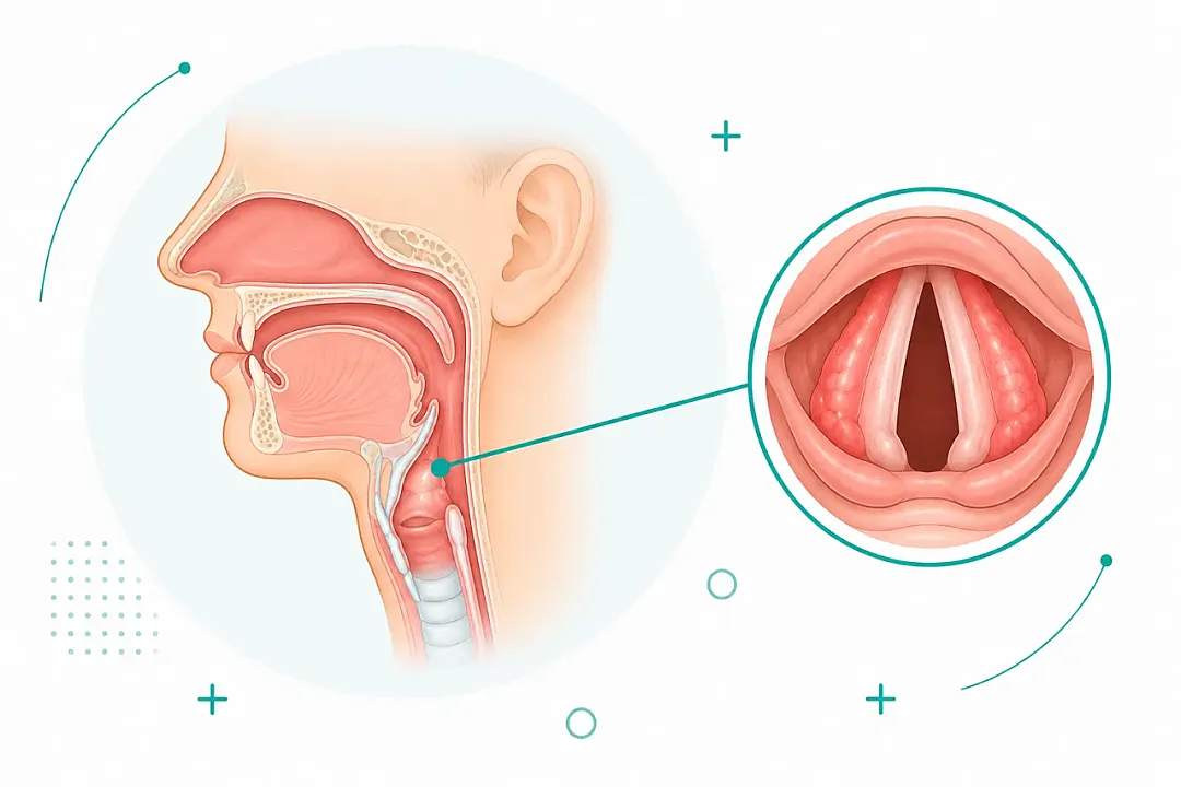 Hoarseness